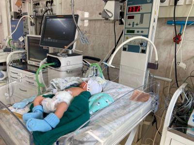 700-граммового младенца выходили в Алматы