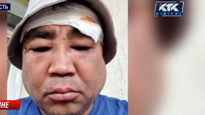 "Не мог прийти в себя": бизнесмен обвинил депутата в избиении в Туркестанской области