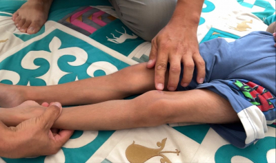 Массажист без диплома сломал ногу ребенку с инвалидностью в Жанаозене