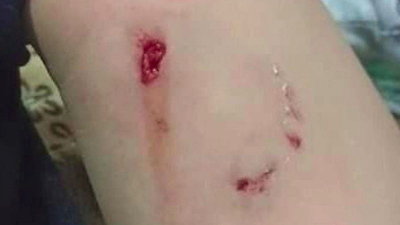 Семилетнюю девочку покусала собака в Усть-Каменогорске