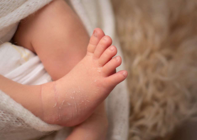 Неонатальная смертность значительно снизилась в Казахстане