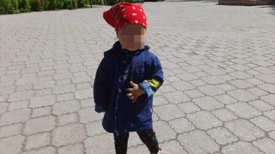 Родилась с четырьмя пальцами на одной руке: девочке из Караганды нужна операция