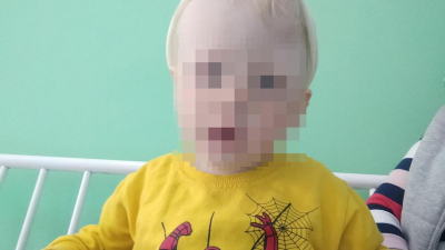 "Голова необычной формы": мальчику из Жамбылской области нужна операция за границей